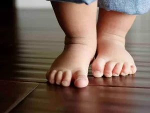 تشخیص صافی کف پا درکودکان