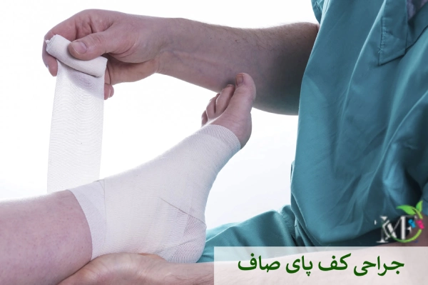جراحی کف پای صاف