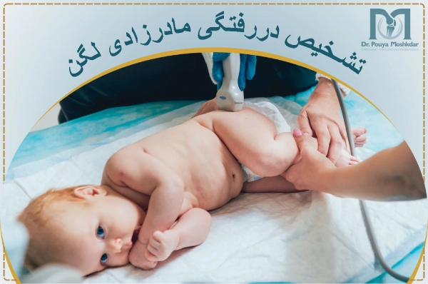 تشخیص دررفتگی مادرزادی لگن