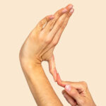 سندرم مارفان