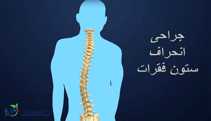 جراحی انحراف ستون فقرات چیست؟