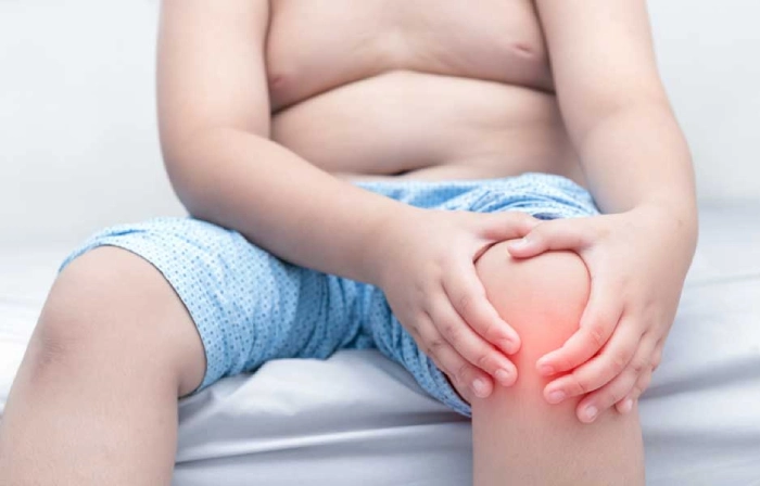 اثرات چاقی کودکان روی سلامت استخوان، مفاصل و عضلات