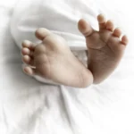 چرخش پنجه پا به داخل (متاتارسوس اداکتوس)