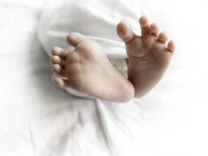 چرخش پنجه پا به داخل (متاتارسوس اداکتوس)