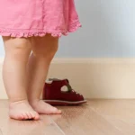 کج گذاشتن پا به سمت بیرون (راه رفتن اردکی کودک)