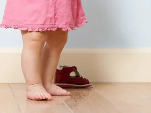 کج گذاشتن پا به سمت بیرون (راه رفتن اردکی کودک)