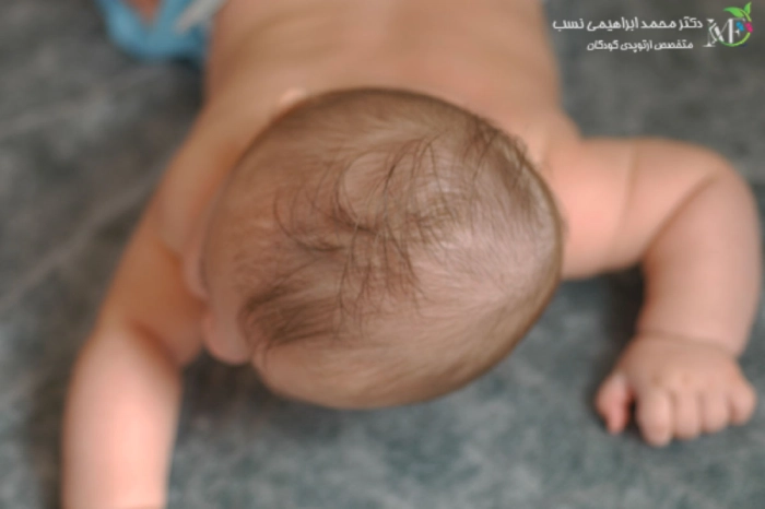 صافی سر نوزاد چیست؟