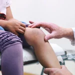 همه چیز درباره جراحی پای ضربدری