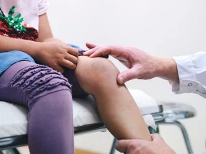 همه چیز درباره جراحی پای ضربدری