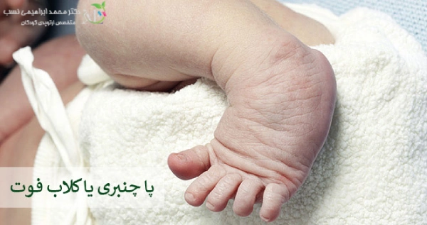 کلاب فوت یا پا چنبری