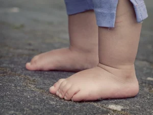 کف پای صاف چیست؟