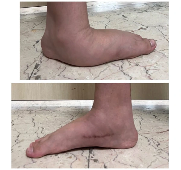 عکس صافی کف پا