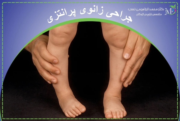 جراحی پای پرانتزی چیست؟