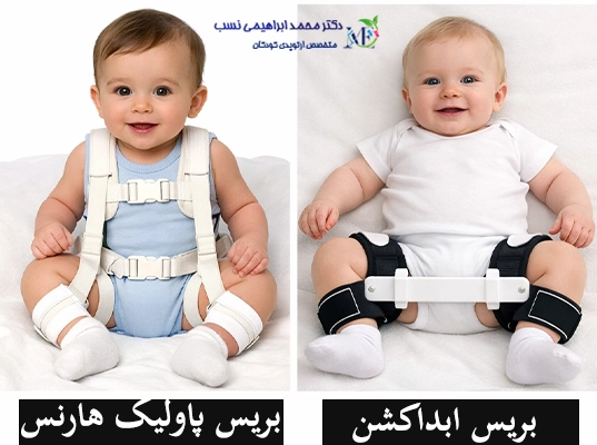 روشهای درمان دررفتگی مادرزادی لگن