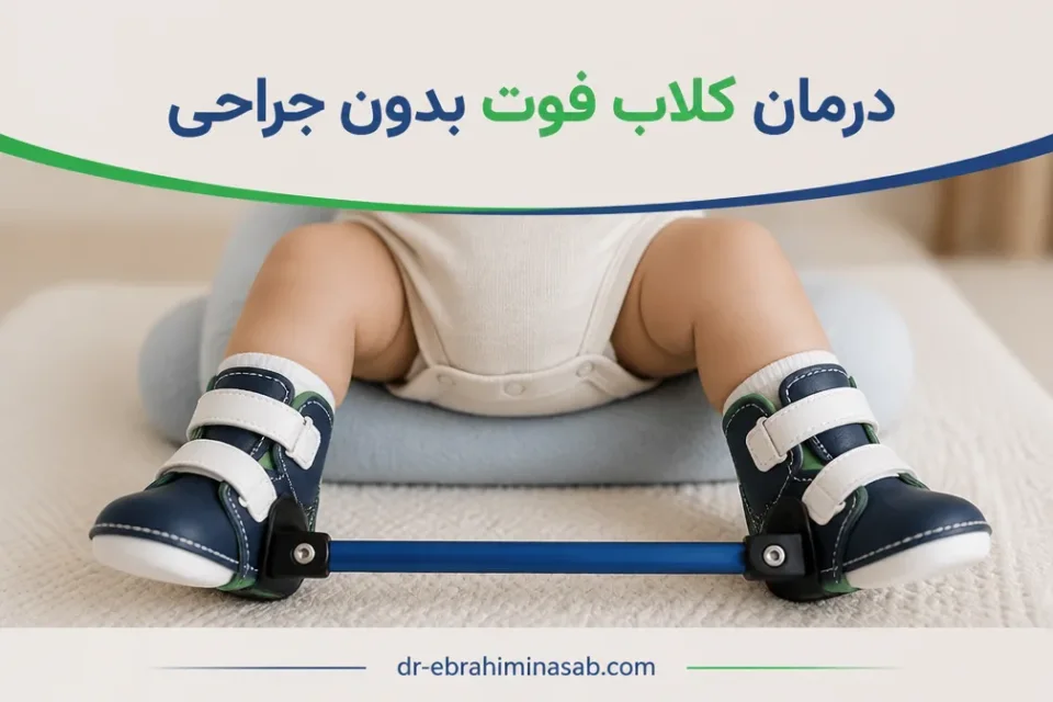 بریس چرا پس از گچگیری ضروری است — استفاده از بریس پس از درمان غیرجراحی کلاب فوت
